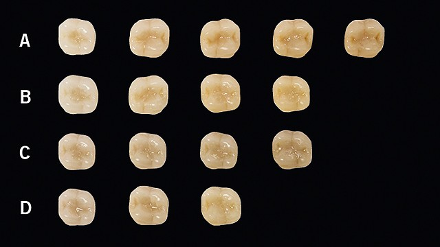 venus-pearl-one-artificial-teeth-image-640w-360h.jpg